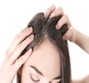 रूसी (Dandruff) को प्राकृतिक रूप से ठीक करने के घरेलू उपाय