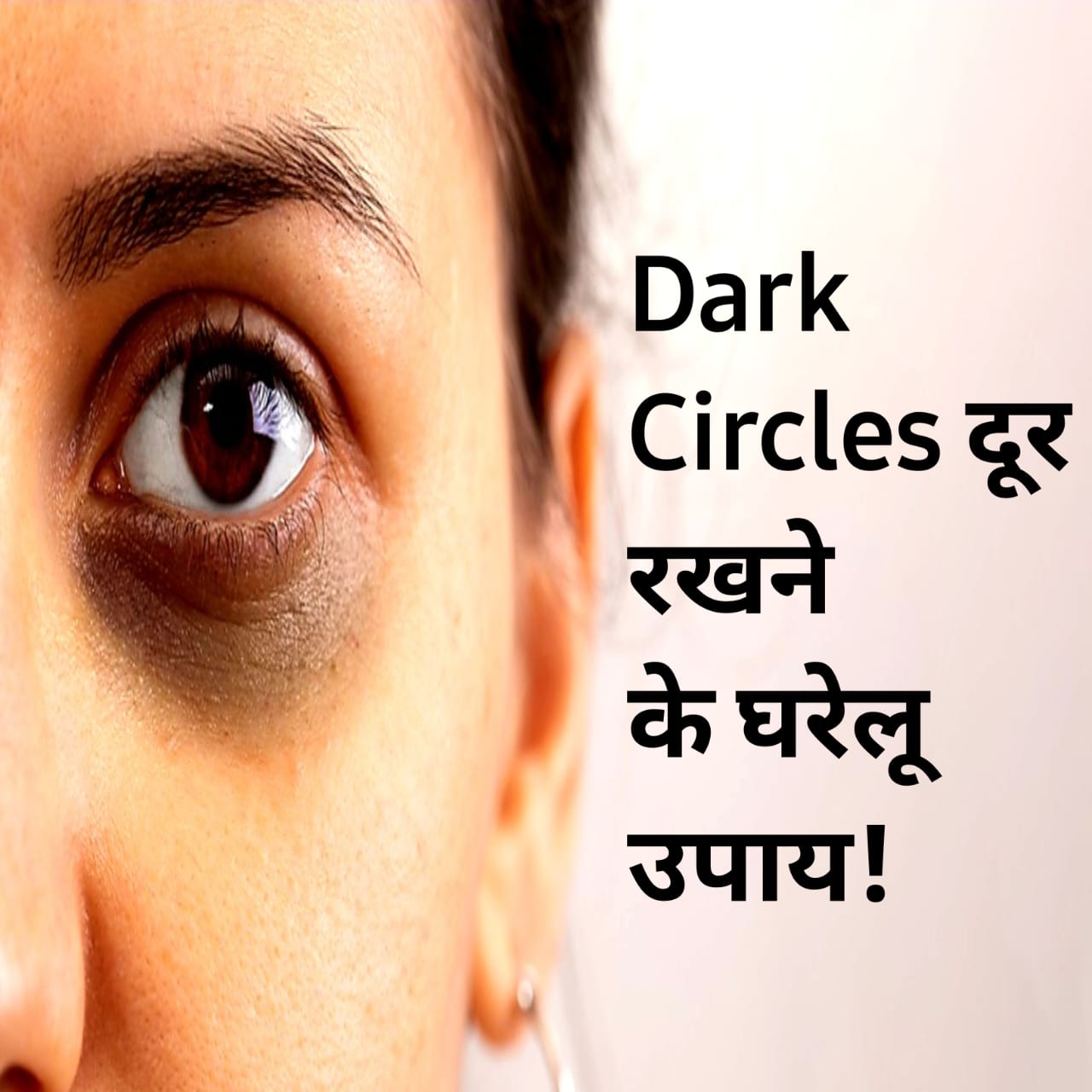 Dark Circles दूर रखने के घरेलू उपाय!